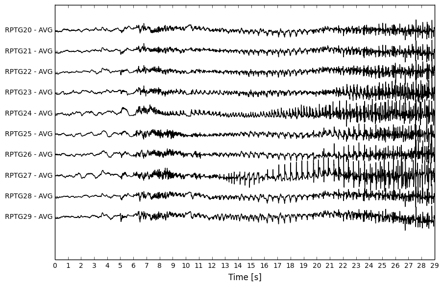 ieeg_source